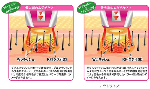 ワイドフラッシュアクセラレーションRF YMO-77